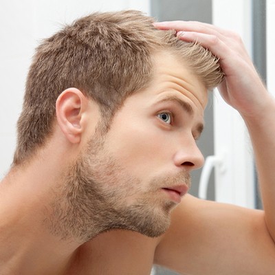 ریزش موی مردان و اصلی ترین دلایل آن